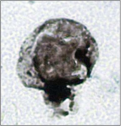 бесклеточная