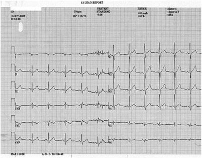 исследование