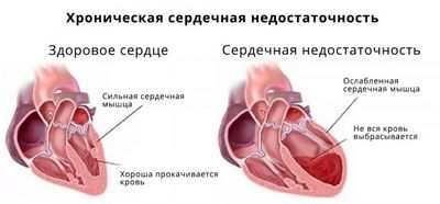 риск риск