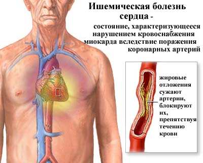 осведомленность