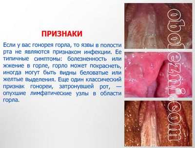 гонорея гонорея