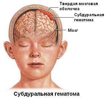 риск риск