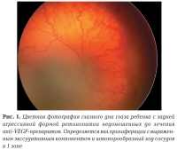 Ретинопатия недоношенных: новые разработки вселяют надежду