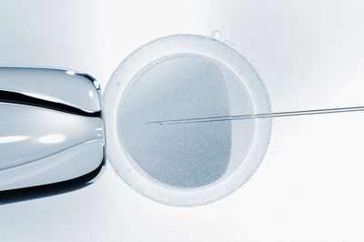 Отбор эмбрионов на основе генов: на горизонте грядут &laquo;дизайнерские младенцы&raquo;?