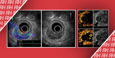Новые методы визуализации влияют на диагностику заболеваний пищеварительной системы