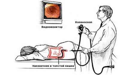 Исследования изучают ретроскоп третьего глаза во время колоноскопии